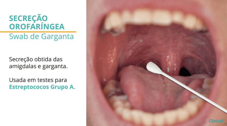 Estreptococos: Teste rápido para infecção de garganta